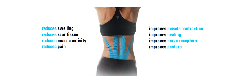 kinesio-taping